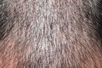 Hair Vitalizer Serum