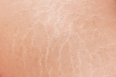 Tissue Firming Serum